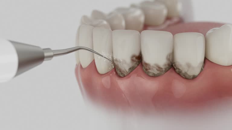 Trusted Tooth Extraction service in Lewiston, ME - Dentist Open Now